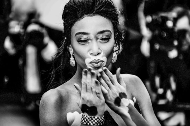 Winnie Harlow
